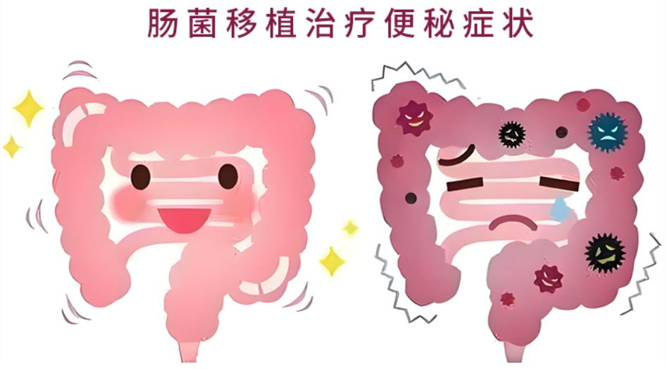 粪菌移植：十年便秘终得解，婆婆重拾生活乐